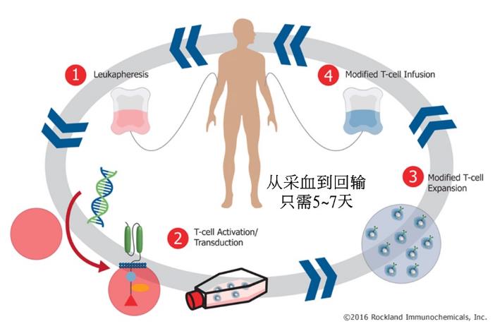 淋巴瘤的CAR-T应用进入二线治疗策略